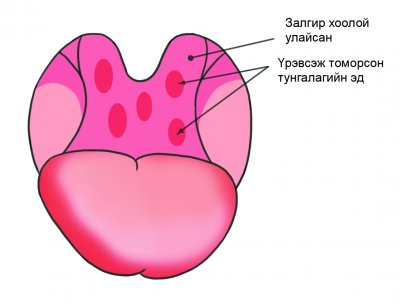 Хоолойны махны үрэвсэл нь залгиурын үрэвсэлээс ялгаатай юу?